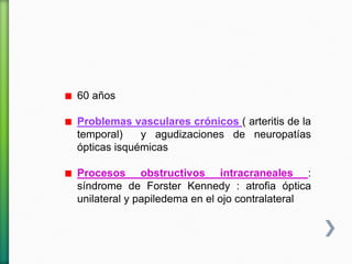 60 años
Problemas vasculares crónicos ( arteritis de la
temporal) y agudizaciones de neuropatías
ópticas isquémicas
Procesos obstructivos intracraneales :
síndrome de Forster Kennedy : atrofia óptica
unilateral y papiledema en el ojo contralateral
 