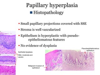 Papillary Dysfunction Papillary lesions | PDF