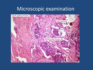 Microscopic examination
 