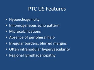 PTC US Features
• Hypoechogenicity
• Inhomogeneous echo pattern
• Microcalcifications
• Absence of peripheral halo
• Irregular borders, blurred margins
• Often intranodular hypervascularity
• Regional lymphadenopathy
 