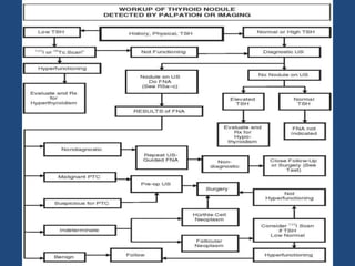 Papillary thyroid cancer 