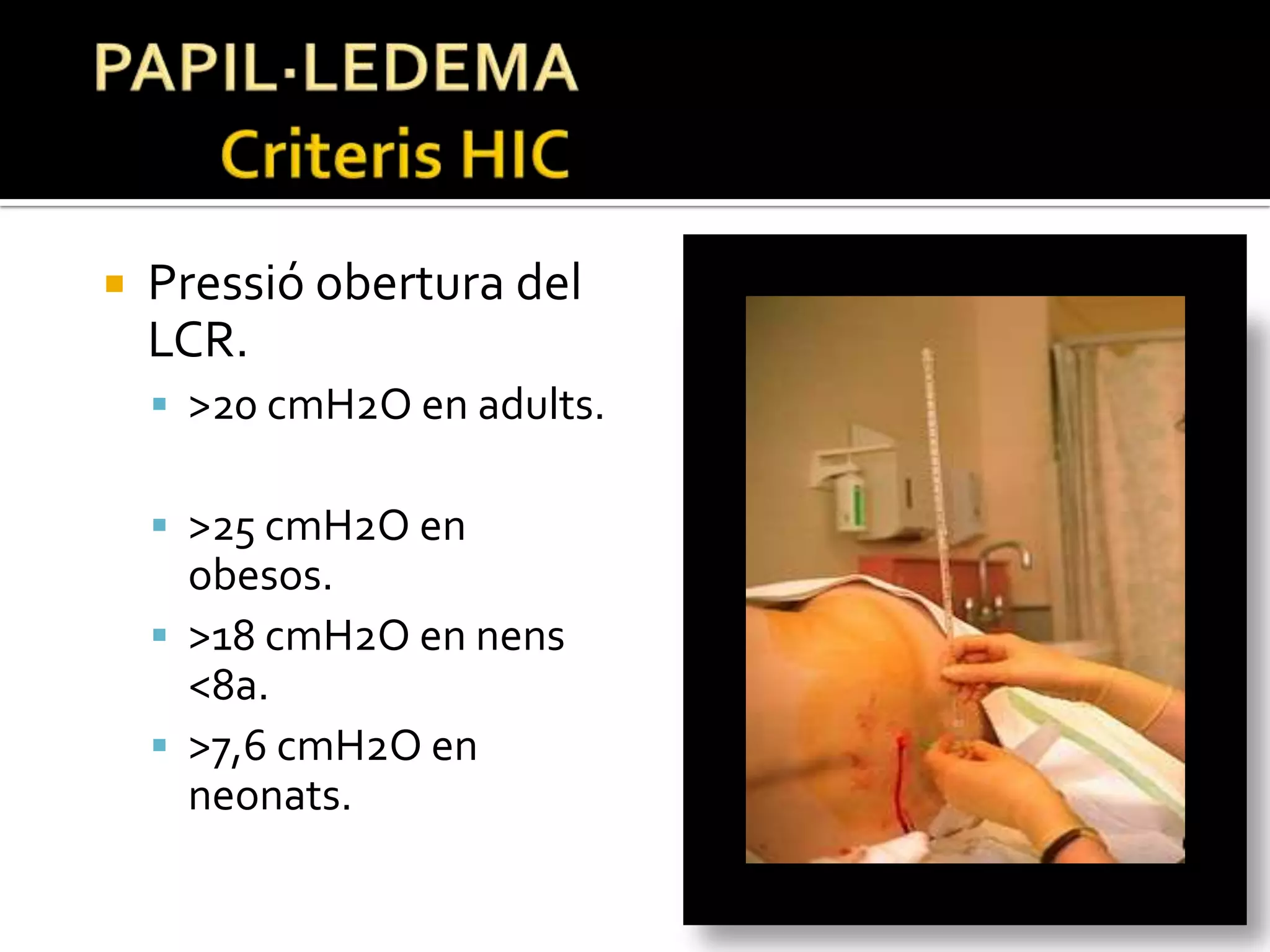 PAPIL·LEDEMA	Criteris HICPressió obertura del LCR.>20 cmH2O en adults.>25 cmH2O en obesos.>18 cmH2O en nens <8a.>7,6 cmH2O en neonats.