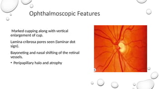 Comprehensive Overview of Papilledema and Optic Atrophy: Causes ...