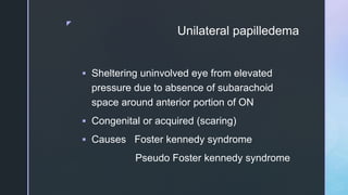 z
Unilateral papilledema
 Sheltering uninvolved eye from elevated
pressure due to absence of subarachoid
space around anterior portion of ON
 Congenital or acquired (scaring)
 Causes Foster kennedy syndrome
Pseudo Foster kennedy syndrome
 