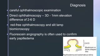 z
Diagnosis
 careful ophthalmoscopic examination
 Direct ophthalmoscopy – 3D - 1mm elevation
difference of 2-6 D
 red-free ophthalmoscopy and slit lamp
biomicroscopy
 Fluorescein angiography is often used to confirm
early papilledema
 
