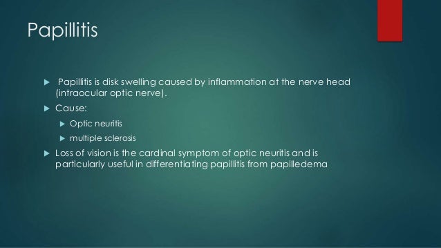 papillitis