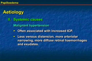 Papilloedema
Aetiology
II. Systemic causes
Malignant hypertension
 Often associated with increased ICP.
 Less venous distension, more arteriolar
narrowing, more diffuse retinal haemorrhages
and exudates.
 