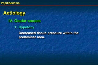 Papilloedema
Aetiology
IV. Ocular causes
1. Hypotony
Decreased tissue pressure within the
prelaminar area.
 