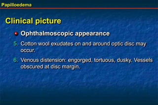 Papilloedema
Clinical picture
Ophthalmoscopic appearance
5. Cotton wool exudates on and around optic disc may
occur.
6. Venous distension: engorged, tortuous, dusky. Vessels
obscured at disc margin.
 