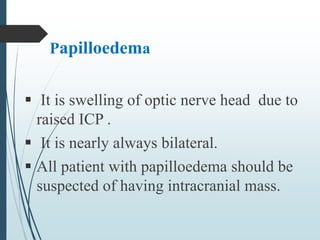 Papilloedema
 It is swelling of optic nerve head due to
raised ICP .
 It is nearly always bilateral.
 All patient with papilloedema should be
suspected of having intracranial mass.
 