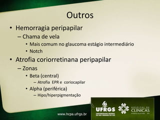 Outros
• Hemorragia peripapilar
– Chama de vela
• Mais comum no glaucoma estágio intermediário
• Notch
• Atrofia coriorretinana peripapilar
– Zonas
• Beta (central)
– Atrofia EPR e coriocapilar
• Alpha (periférica)
– Hipo/hiperpigmentação
 