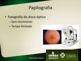 Papilografia
• Fotografia do disco óptico
– Sem movimento
– Tempo ilimitado
 