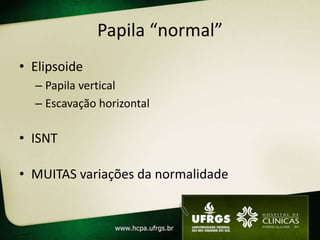Papila “normal”
• Elipsoide
– Papila vertical
– Escavação horizontal
• ISNT
• MUITAS variações da normalidade
 
