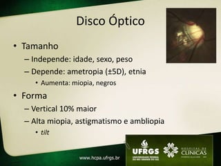 Disco Óptico
• Tamanho
– Independe: idade, sexo, peso
– Depende: ametropia (±5D), etnia
• Aumenta: miopia, negros
• Forma
– Vertical 10% maior
– Alta miopia, astigmatismo e ambliopia
• tilt
 
