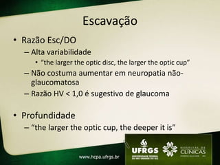 Escavação
• Razão Esc/DO
– Alta variabilidade
• “the larger the optic disc, the larger the optic cup”
– Não costuma aumentar em neuropatia não-
glaucomatosa
– Razão HV < 1,0 é sugestivo de glaucoma
• Profundidade
– “the larger the optic cup, the deeper it is”
 