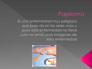 Papiloma Es una enfermedad muy peligrosa que pues da en los seres vivos y pues esta enfermedad no tiene cura ve amos unas imágenes de esta enfermedad 