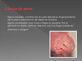 Papiloma humano 23 | PPT