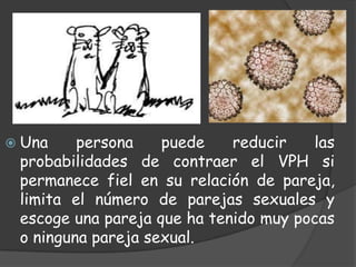  Una    persona    puede    reducir   las
 probabilidades de contraer el VPH si
 permanece fiel en su relación de pareja,
 limita el número de parejas sexuales y
 escoge una pareja que ha tenido muy pocas
 o ninguna pareja sexual.
 