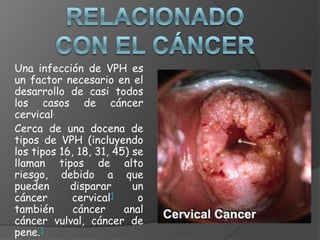 Una infección de VPH es
un factor necesario en el
desarrollo de casi todos
los casos de cáncer
cervical.
Cerca de una docena de
tipos de VPH (incluyendo
los tipos 16, 18, 31, 45) se
llaman tipos de alto
riesgo, debido a que
pueden      disparar      un
cáncer      cervical]      o
también      cáncer     anal
cáncer vulval, cáncer de
pene.]
 