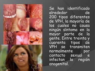Se han identificado
alrededor           de
200 tipos diferentes
de VPH, la mayoría de
los cuales no causa
ningún síntoma en la
mayor parte de la
gente. Entre treinta y
cuarenta tipos de
VPH se transmiten
normalmente        por
contacto sexual e
infectan la región
anogenital.
 