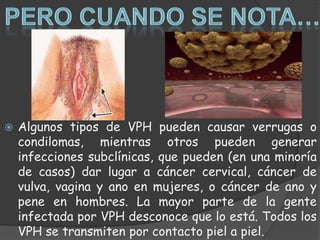    Algunos tipos de VPH pueden causar verrugas o
    condilomas, mientras otros pueden generar
    infecciones subclínicas, que pueden (en una minoría
    de casos) dar lugar a cáncer cervical, cáncer de
    vulva, vagina y ano en mujeres, o cáncer de ano y
    pene en hombres. La mayor parte de la gente
    infectada por VPH desconoce que lo está. Todos los
    VPH se transmiten por contacto piel a piel.
 