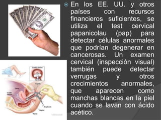    En los EE. UU. y otros
    países      con     recursos
    financieros suficientes, se
    utiliza el test cervical
    papanicolau (pap) para
    detectar células anormales
    que podrían degenerar en
    cancerosas. Un examen
    cervical (inspección visual)
    también puede detectar
    verrugas        y      otros
    crecimientos      anormales,
    que      aparecen      como
    manchas blancas en la piel
    cuando se lavan con ácido
    acético.
 