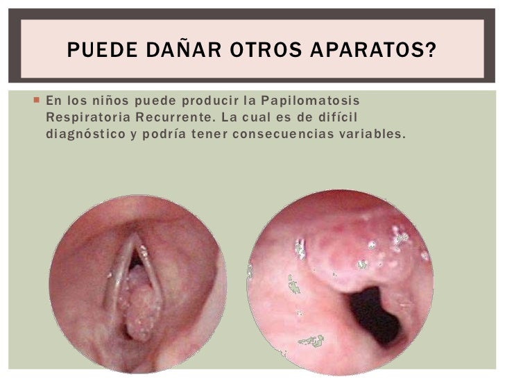 Los consejos del aumento del miembro