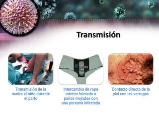 Transmisión
Transmisión de la
madre al niño durante
el parto
Intercambio de ropa
interior húmeda o
paños mojados con
una persona infectada
Contacto directo de la
piel con las verrugas
 