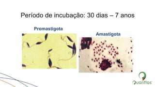 Período de incubação: 30 dias – 7 anos
Promastigota
Amastigota
 