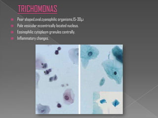    Pear shaped,oval,cyanophilic organisms,15-30μ
   Pale vesicular eccentrically located nucleus.
   Eosinophilic cytoplasm granules centrally.
   Inflammatory changes.
 