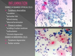 CHANGES IN SQUAMOUS EPITHELIAL CELLS-
 Cytoplasmic abnormalities
 *vacuolation
 *perinuclear halo
 *altered staining
 *abnormal keratinisation
 Changes in nucleaus-
 *wrinkling of nuclear membrane
 *multinucleation
 *chromatin degeneration
CHANGES IN ENDOCERVICAL CELLS-
 Cytoplasmic degeneration
 Nuclear variation
 