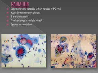    Cell size markedly increased without increase in N/C ratio.
   Nuclei show degenerative changes
   Bi or multinucleation
   Prominent single or multiple nucleoli
   Cytoplasmic vacuolation
 