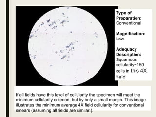 Comprehensive Guide to Pap Smear Technique and Cervical Cancer ...