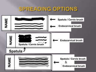 Spatula / Cervix brush
Endocervical brush
Spatula / Cervix brush
Endocervical brush
Endocervical brush
Spatula / Cervix brush
 