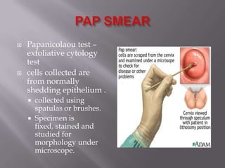  Papanicolaou test –
exfoliative cytology
test
 cells collected are
from normally
shedding epithelium .
 collected using
spatulas or brushes.
 Specimen is
fixed, stained and
studied for
morphology under
microscope.
 