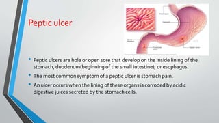 Peptic ulcer
• Peptic ulcers are hole or open sore that develop on the inside lining of the
stomach, duodenum(beginning of the small intestine), or esophagus.
• The most common symptom of a peptic ulcer is stomach pain.
• An ulcer occurs when the lining of these organs is corroded by acidic
digestive juices secreted by the stomach cells.
 