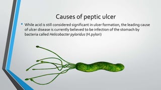 Causes of peptic ulcer
• While acid is still considered significant in ulcer formation, the leading cause
of ulcer disease is currently believed to be infection of the stomach by
bacteria called Helicobacter pyloridus (H.pylori)
 