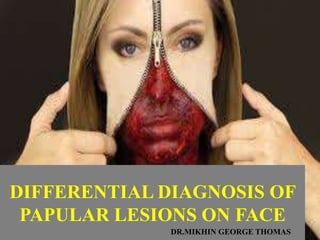 DIFFERENTIAL DIAGNOSIS OF
PAPULAR LESIONS ON FACE
DR.MIKHIN GEORGE THOMAS
 