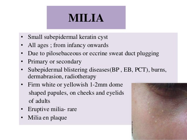 Contoh Surat Cuti Cancer