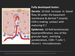 Fully developed lesion:
Dermis: 10-fold increase in blood
flow, M under the basement
membrane & dermal T (mainly
CD4+) making contact with
maturing D ↑
Epidermis: 10-fold keratinocyte
hyperproliferation, loss of the
granular layer, overlying
parakeratosis, CD8+ T cells ↑,
Munro’s microabscesses
Fitzpatrick's dermatology in general medicine. Edisi ke-8. New York: McGraw-Hill; 2012. hlm. 197-232.
 