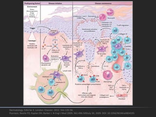 Dermatology. Edisi ke-3. London: Elsevier; 2012. hlm 135-56.
Psoriasis. Nestle FO, Kaplan DH, Barker J. N Engl J Med 2009; 361:496-509July 30, 2009. DOI: 10.1056/NEJMra0804595
 