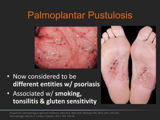 Palmoplantar Pustulosis
Fitzpatrick's dermatology in general medicine. Edisi ke-8. New York: McGraw-Hill; 2012. hlm. 197-232.
Dermatology. Edisi ke-3. London: Elsevier; 2012. hlm 135-56.
• Now considered to be
different entities w/ psoriasis
• Associated w/ smoking,
tonsilitis & gluten sensitivity
 