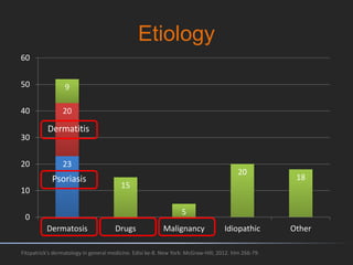 Etiology
23
20
9
15
5
20
18
0
10
20
30
40
50
60
Dermatosis Drugs Malignancy Idiopathic Other
Fitzpatrick's dermatology in general medicine. Edisi ke-8. New York: McGraw-Hill; 2012. hlm 266-79.
Psoriasis
Dermatitis
 