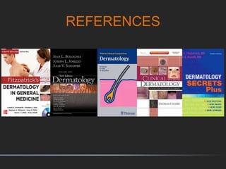 REFERENCES
 