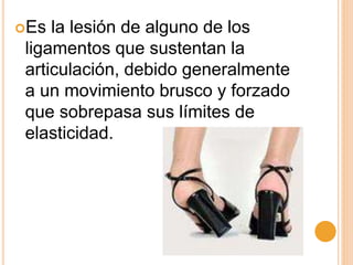 Es la lesión de alguno de los
ligamentos que sustentan la
articulación, debido generalmente
a un movimiento brusco y forzado
que sobrepasa sus límites de
elasticidad.
 