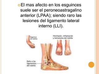 El mas afecto en los esguinces
suele ser el peroneoastragalino
anterior (LPAA); siendo raro las
lesiones del ligamento lateral
interno (LLI).
 
