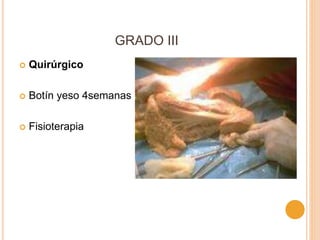 GRADO III
 Quirúrgico
 Botín yeso 4semanas
 Fisioterapia
 