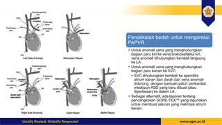papvd partial anomalous pulmonary vein drainage.pptx