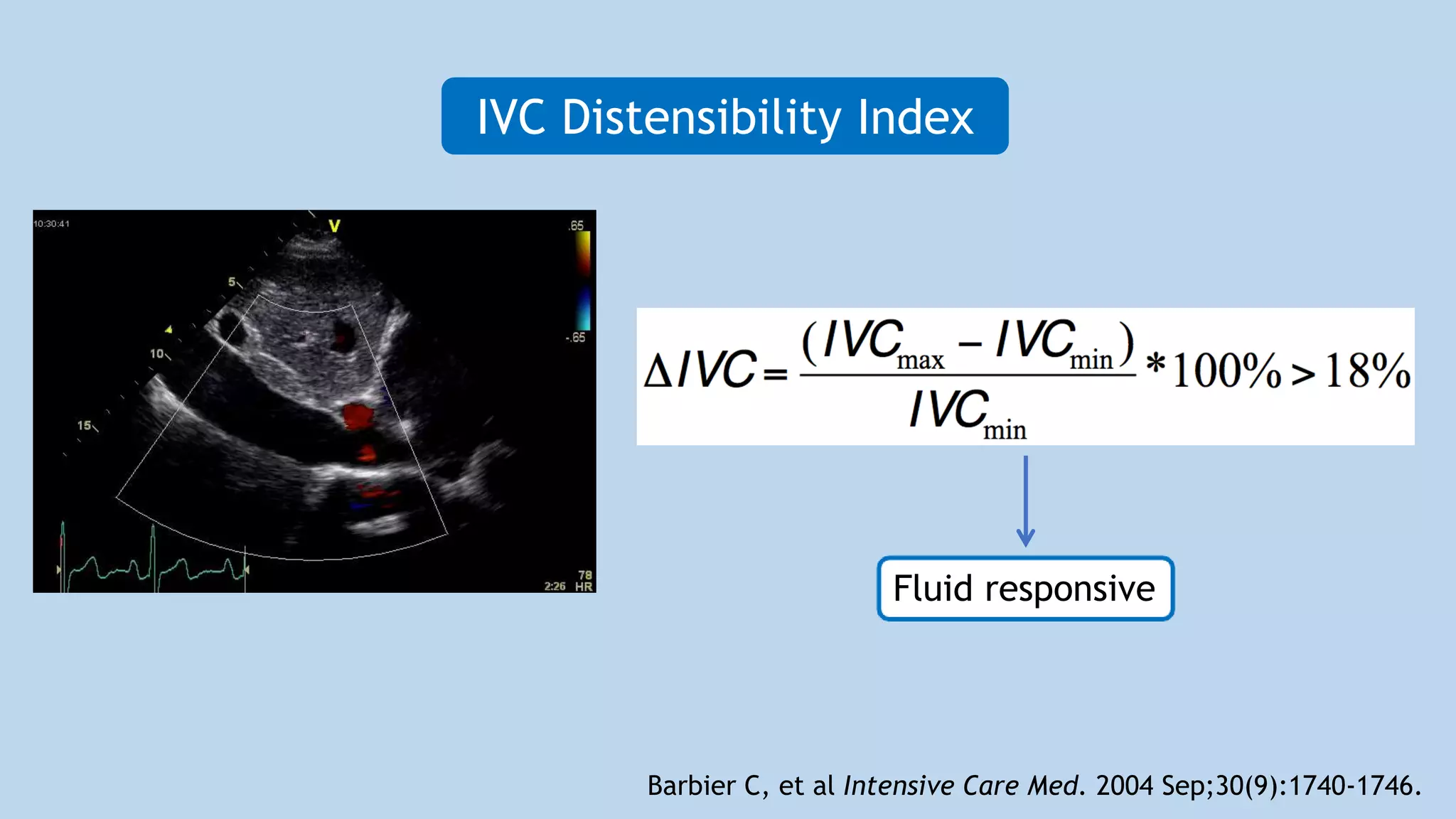 Non-invasive haemodynamic monitoring by Echocardiography | PPTX