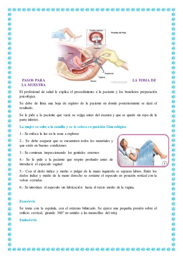 preparacion para realizar papanicolaou